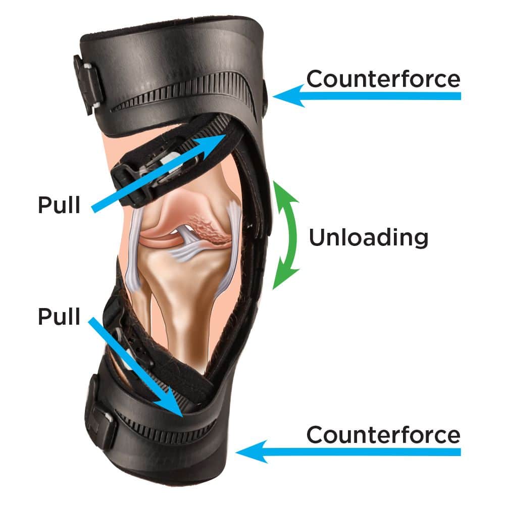 Breg Quantum OA kniebrace